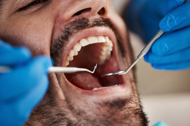Emergency Dental Services in Celina, OH